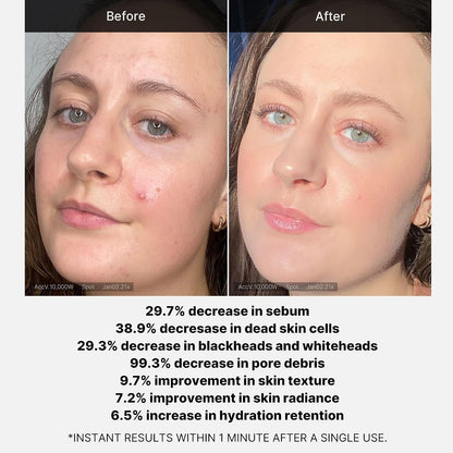 Wash-off Resurfacing Serum