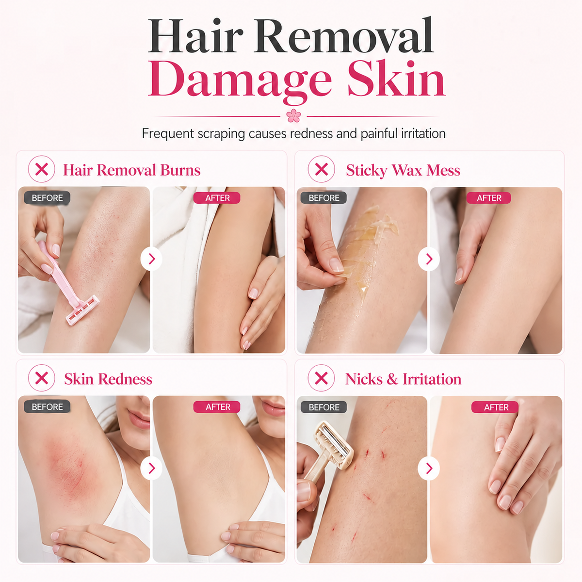 Gentle Smooth Roll-On Body Hair Removal